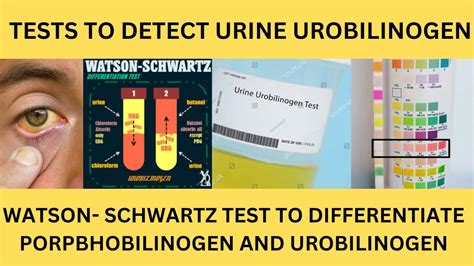 watson schwartz urine test.